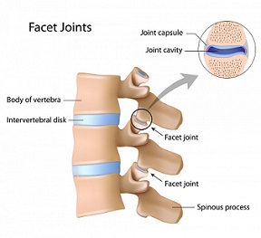 Facet Block Injections          